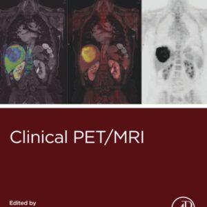 Clinical PET/MRI