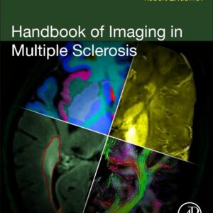 Handbook of Imaging in Multiple Sclerosis