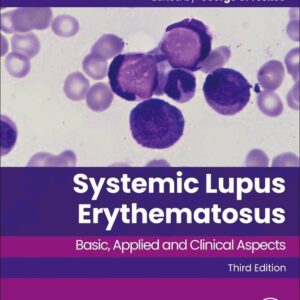 Systemic Lupus Erythematosus: Basic