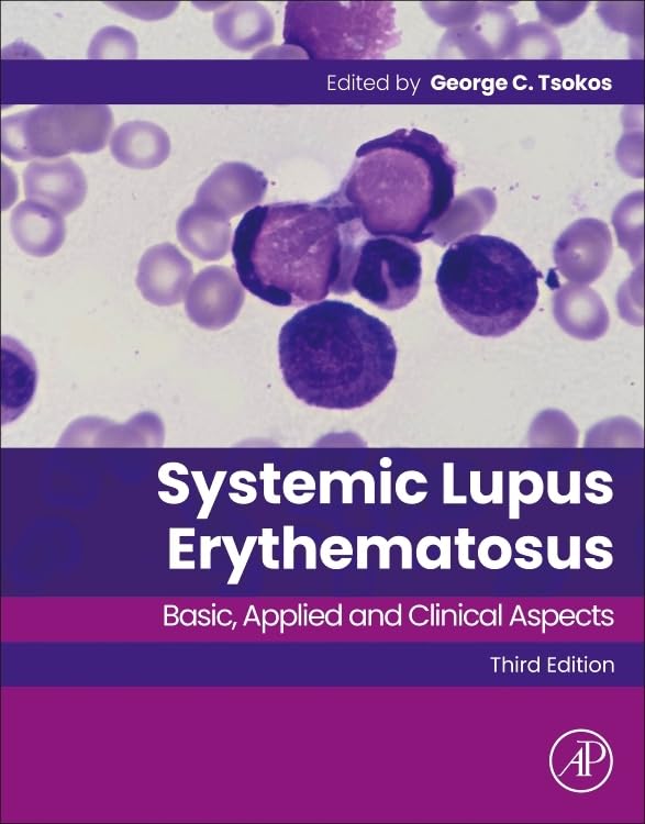 Systemic Lupus Erythematosus: Basic