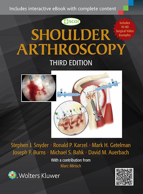Shoulder Arthroscopy-ISBN: 9781451191707
