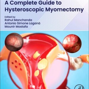 A Complete Guide to Hysteroscopic Myomectomy