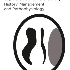 Intracranial Epidural Bleeding: History