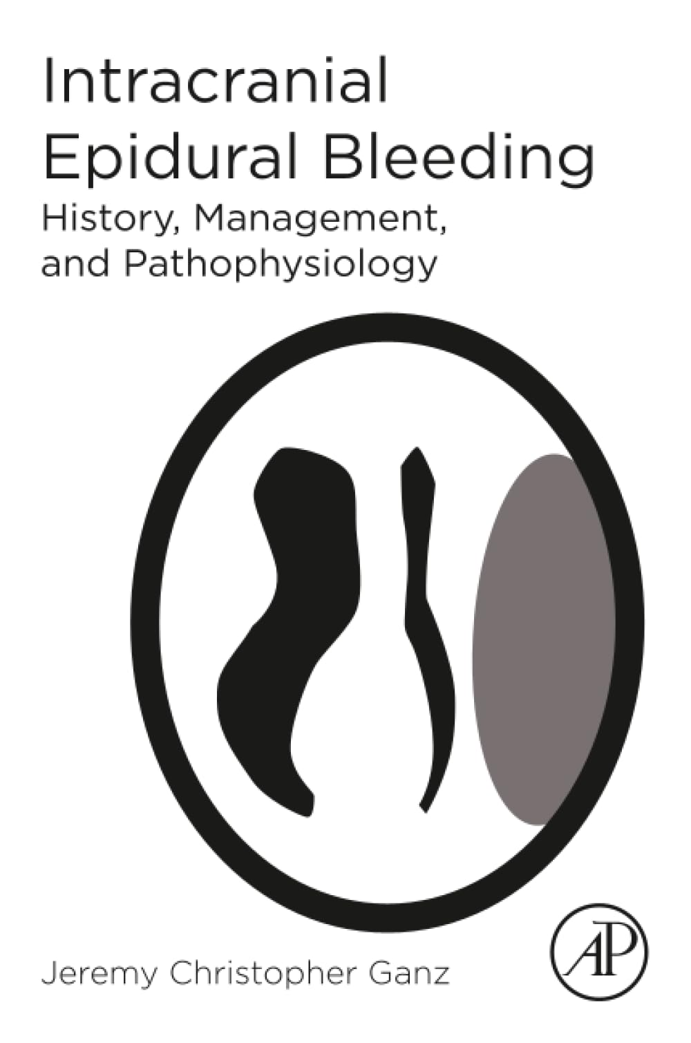 Intracranial Epidural Bleeding: History
