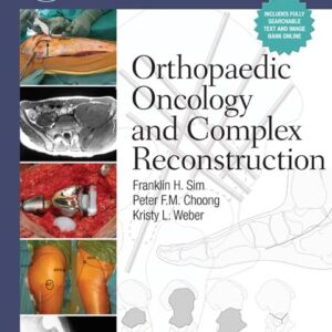 Master Techniques in Orthopaedic Surgery: Orthopaedic Oncology and Complex Reconstruction-ISBN: 9781608310432