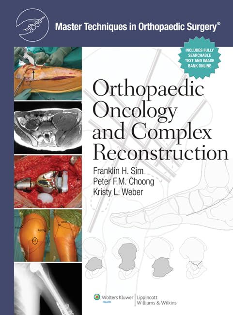 Master Techniques in Orthopaedic Surgery: Orthopaedic Oncology and Complex Reconstruction-ISBN: 9781608310432