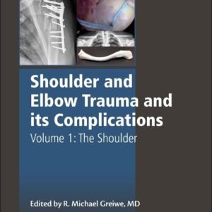 Shoulder and Elbow Trauma and its Complications: Volume 1: The Shoulder (Woodhead Publishing Series in Biomaterials)