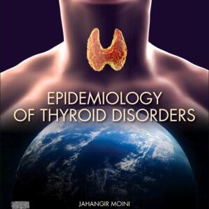 Epidemiology of Thyroid Disorders