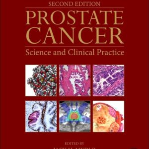 Prostate Cancer: Science and Clinical Practice