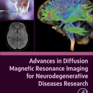 Advances in Diffusion Magnetic Resonance Imaging for Neurodegenerative Diseases Research