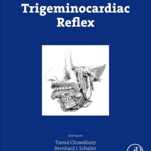 Trigeminocardiac Reflex