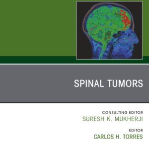 Spinal Tumors