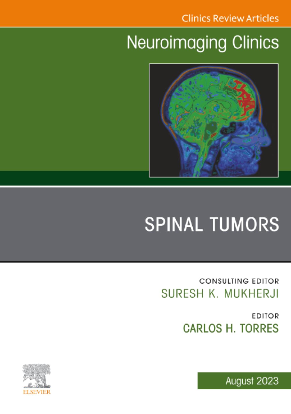 Spinal Tumors