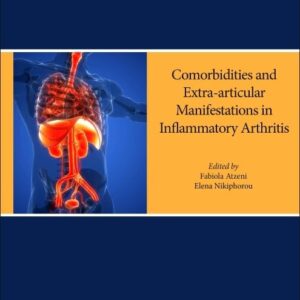 Comorbidities in Inflammatory Arthritis: Volume 18 in the Handbook of Systemic Autoimmune Diseases series (Volume 18)