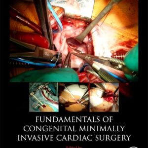 Fundamentals of Congenital Minimally Invasive Cardiac Surgery