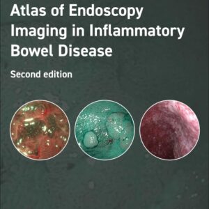 Atlas of Endoscopy Imaging in Inflammatory Bowel Disease