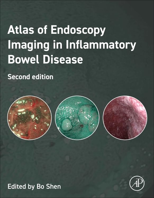 Atlas of Endoscopy Imaging in Inflammatory Bowel Disease