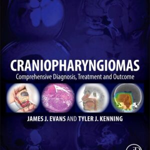 Craniopharyngiomas: Comprehensive Diagnosis