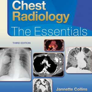 Chest Radiology: The Essentials (Essentials Series)-ISBN: 9781451144482