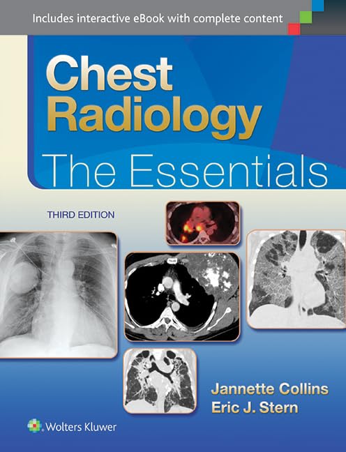 Chest Radiology: The Essentials (Essentials Series)-ISBN: 9781451144482