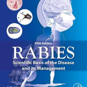 Rabies: Scientific Basis of the Disease and Its Management