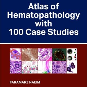 Atlas of Hematopathology with 100 Case Studies