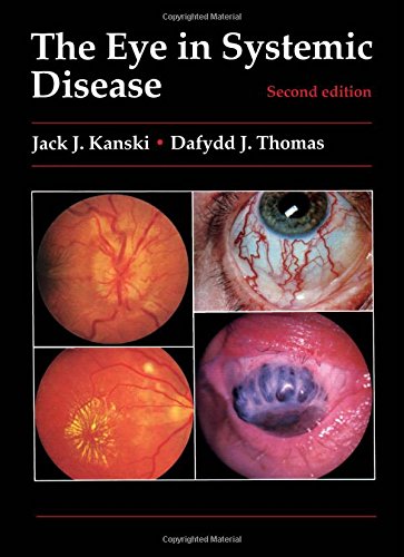 The Eye in Systemic Disease