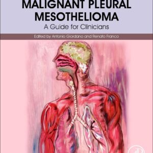 Malignant Pleural Mesothelioma: A Guide for Clinicians