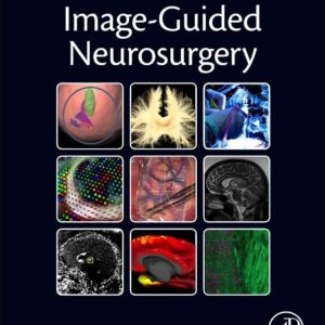Image-Guided Neurosurgery