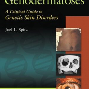 Genodermatoses: A Clinical Guide to Genetic Skin Disorders-ISBN: 9780781740883