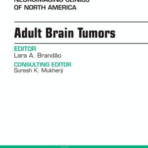 Adult Brain Tumors