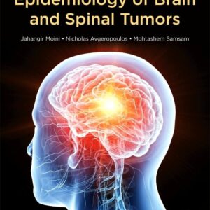 Epidemiology of Brain and Spinal Tumors