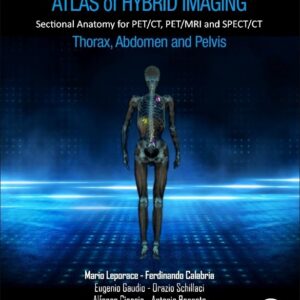 Atlas of Hybrid Imaging Sectional Anatomy for PET/CT