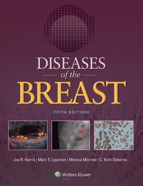 Diseases of the Breast 5e-ISBN: 9781451186277