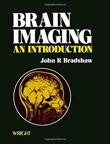 Brain Imaging: An Introduction