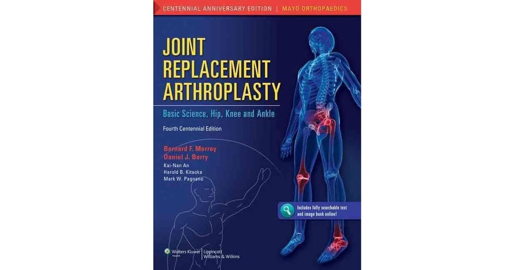 Joint Replacement Arthroplasty: Basic Science