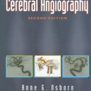 Diagnostic Cerebral Angiography-ISBN: 9780397584048