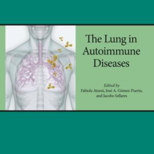 The Lung in Autoimmune Diseases (Volume 17) (Handbook of Systemic Autoimmune Diseases
