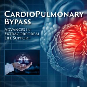 Cardiopulmonary Bypass: Advances in Extracorporeal Life Support