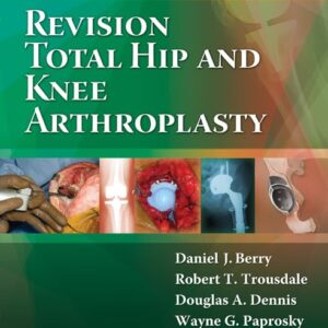 Revision Total Hip and Knee Arthroplasty-ISBN: 9780781760430