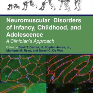 Neuromuscular Disorders of Infancy