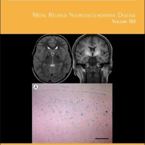 Metal Related Neurodegenerative Disease (Volume 110) (International Review of Neurobiology
