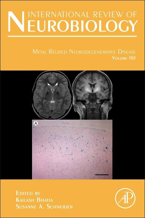 Metal Related Neurodegenerative Disease (Volume 110) (International Review of Neurobiology