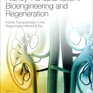 Kidney Transplantation