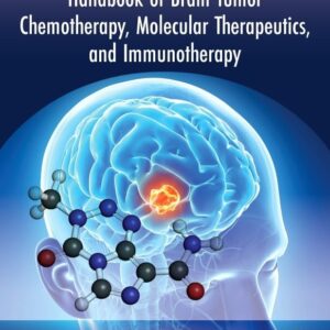Handbook of Brain Tumor Chemotherapy
