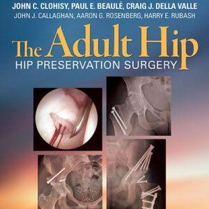 The Adult Hip: Hip Preservation Surgery-ISBN: 9781451183931