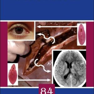 Advances in Parasitology (Volume 84)