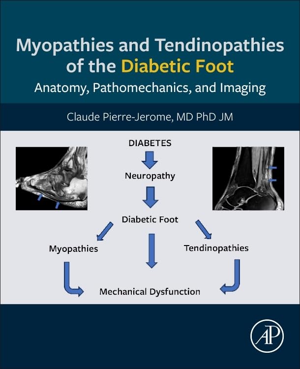 Myopathies and Tendinopathies of the Diabetic Foot: Anatomy