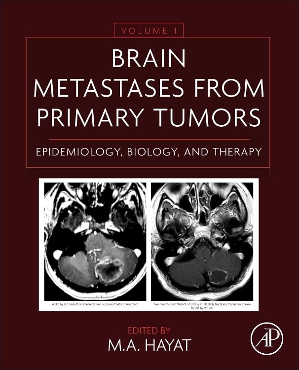 Brain Metastases from Primary Tumors Volume 1: Epidemiology