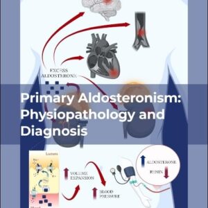 Primary Aldosteronism: Physiopathology and Diagnosis (Volume 130) (Vitamins and Hormones
